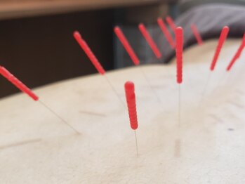 栄光治院 安城院/鍼で自律神経調節！