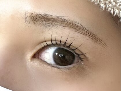 チョキナ(chokina.)の写真