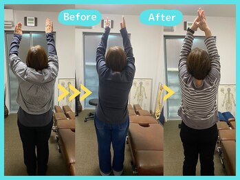 京都中丸整体カイロプラクティック/肩の痛み