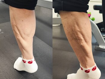 マチトレ 市ヶ谷店/70代でもこのふくらはぎ！