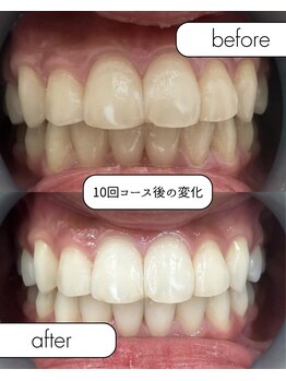 ホワイトニングショップ 栃木佐野店/