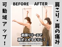 カンナ(KANNA)/50代　女性　施術例