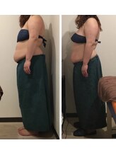 リズ(Liz)/光痩身