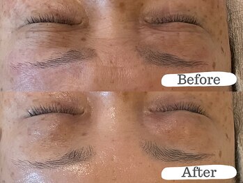 シーン(Sheen)/小じわやくすみ改善に◎