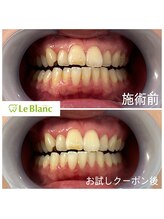 ルブラン 奈良店(Le Blanc)/歯が気になり始めたら