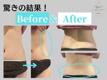 フローフシ∞/【お腹BA】見た目10kg減