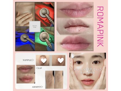 エードット(A.)の写真