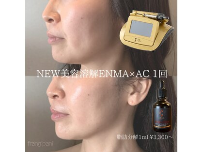 フランジパニ(FRANGIPANI)の写真