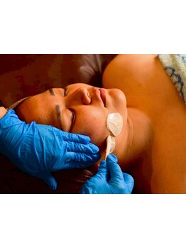 顔脱毛がしたい