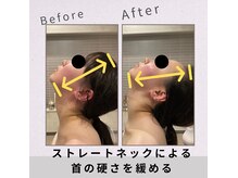 指では届かない！インディバ独自の深部加温でコリを緩めて楽に♪