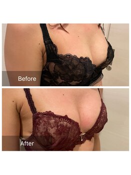 ジェミニ(Gemini)/ふわふわバストアップ