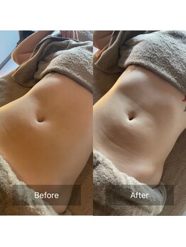 マル(MARU)/よもぎ蒸し+腸もみで不調解消