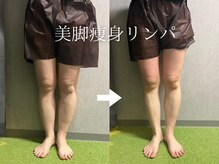 ヴィオラプラス(violla Plus+)の雰囲気（【大人気！】30分間でむくみ撃退！小顔矯正・ウエスト引締めも！）