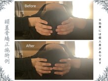 ボディ リセット アンド デザイン(Body Reset & Design)/【施術例】ビフォーアフター