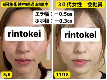 凛と慶/30代女性の施術変化