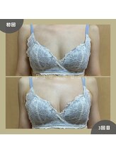 プラス バスト(+Plusバスト)/お客様BeforeAfterお写真