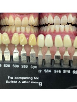 トウキョウスワーズ 池袋店(TOKYO SWRS)/#ホワイトニング #池袋 #渋谷