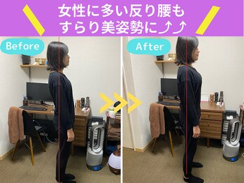 京都中丸整体カイロプラクティック/反り腰＋腰痛