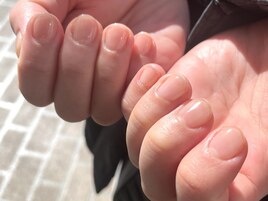 クリアネイル(自爪保護)