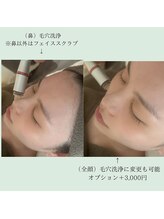 チッチ アフロディーテ(Chicchi Aphrodit)/施術の流れ