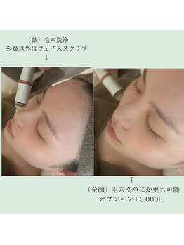 チッチ アフロディーテ(Chicchi Aphrodit)/施術の流れ