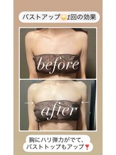 イーストモア(EAST MOIS)/バストアップ1回の効果