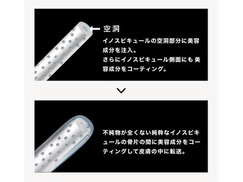 アンフェム(Anfem)/美容爆弾☆肌質改善HARIエステ