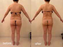 クロレ 浦和店(CLORE)/40代お客様/10回施術