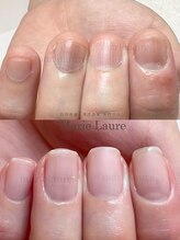 マリーロール 淀屋橋本店(Marie Laure)/深爪矯正/自爪育成/ネイルケア