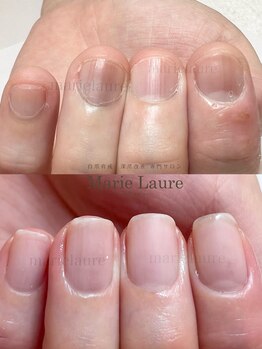 マリーロール 淀屋橋本店(Marie Laure)/深爪矯正/自爪育成/ネイルケア