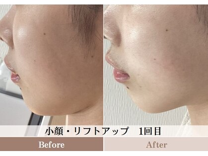 ルピア(L'pur)の写真
