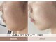 ルピア(L'pur)の写真