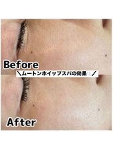 ポワールムース(POIRE mousse)/Before&After写真☆