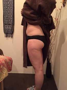 リラクゼーションサロン リブラン(liburan)/ダイエットコース（お腹）before