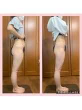 リエル ダイエットアンドビューティー(RIEL diet&beauty)/セル撃退コース　下半身