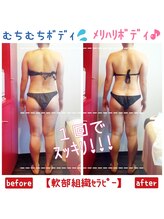 ビューティサロン キヨの部屋(beauty salon)/【軟部組織セラピー】　１回