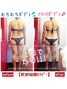 ビューティサロン キヨの部屋(beauty salon)/【軟部組織セラピー】　１回