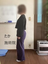 たか施術院/首こり 背中の痛み 20代 学生