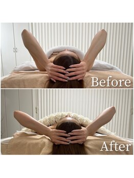 ユカリス(Yu.charis)/小顔ヘッドスパ before→after