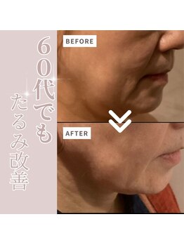 シェリーク 東京店/自己流で効果を感じず決意