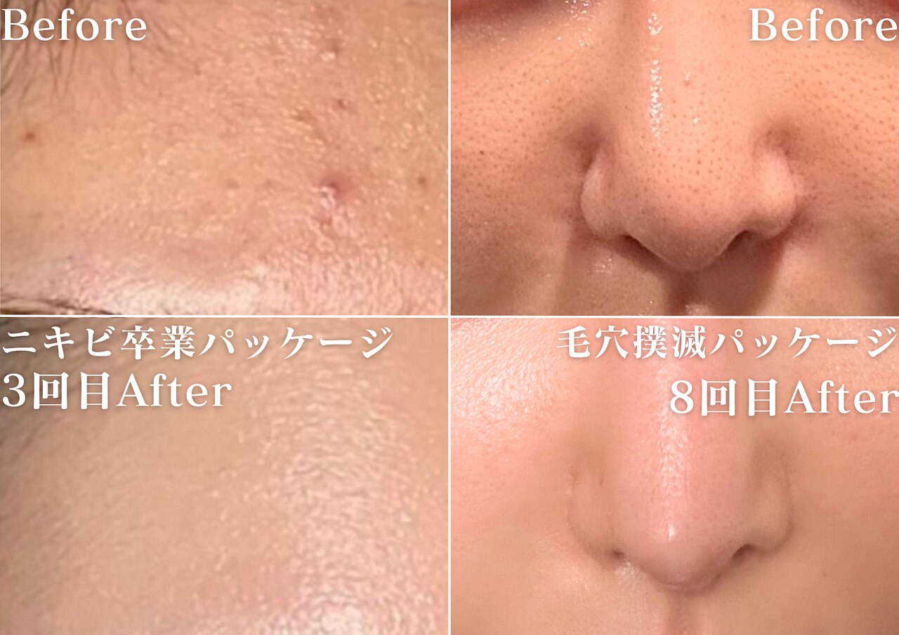 ミニョスキンラボ｜ホットペッパービューティー