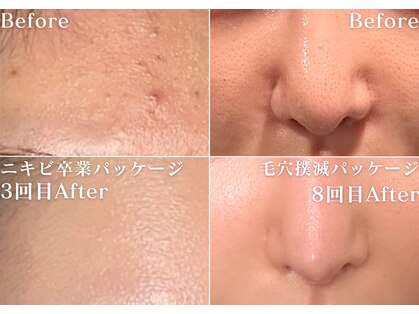 ミニョスキンラボの写真