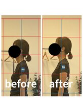 熊本カワル整体 JR上熊本駅院/ストレートネック