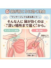 ほぐせる スター鍼灸接骨整体院 竹ノ塚 竹ノ塚東口駅前店/鍼の効果！