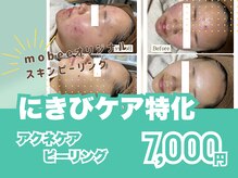 ミンティー 橿原店の雰囲気(20代人気/全身脱毛/都度払い/ブラジリアンワックス/産毛脱毛)