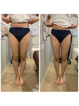 個室整体院キュット/フォースカッター