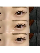 アーラ(ala)/flat×2 （50）