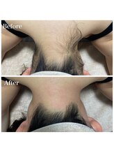 リゲルス(Regel)/うなじワックス脱毛