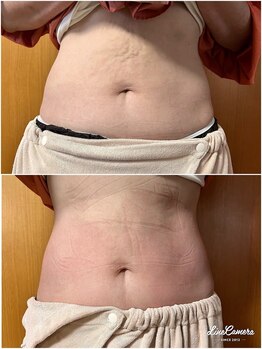 ヒーリングリゾート ナゴミ(Nagomi)/【電磁パルス】