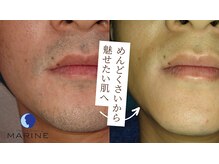 こだわりコスメを使用したフェイシャルメニューもおすすめです♪